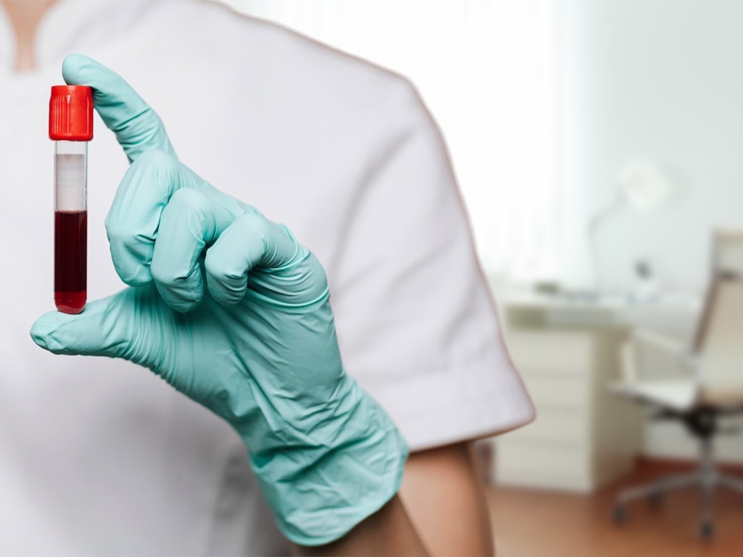 Hematologická ambulance Nemocnice Benešov