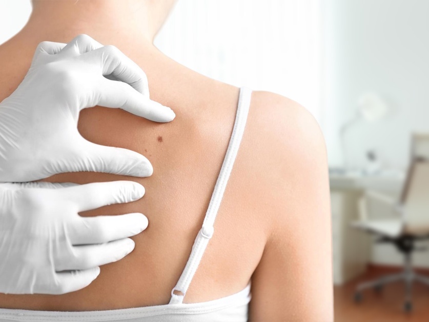 Kožní ordinace Dermacare Krčská - MUDr. Marta Hajasová