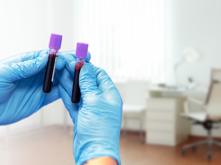 Laboratoř VIDIA-Diagnostika - Nemocnice Sedlčany